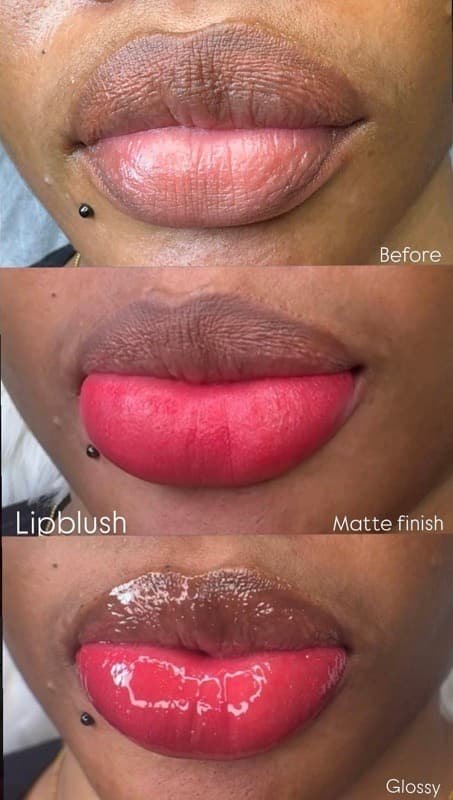 lip blush and neutralization